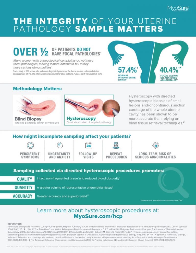 Hologic Myosure - Infographic And Video - Fierce Creative Agency